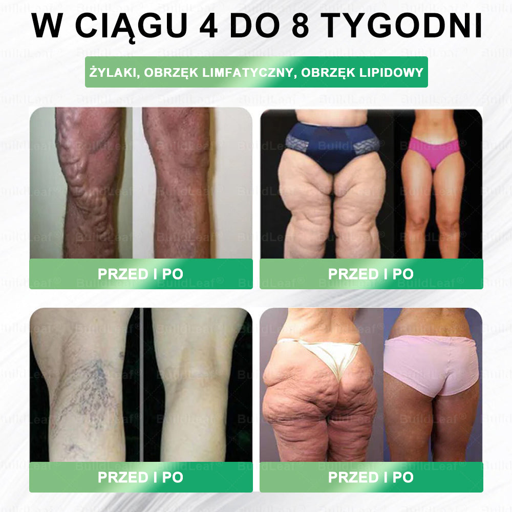 Oficjalny sklep Polska | BuildLeaf® GLP-1 8-w-1 Fit & Vital Rozwiązanie (Jednorazowe dziennie, widoczne zmiany w ciągu 7 dni) ✅ Otyłość, zdrowie sercowo-naczyniowe, cukrzyca, bezdech senny, zdrowie jelit, problemy ze stawami i inne.