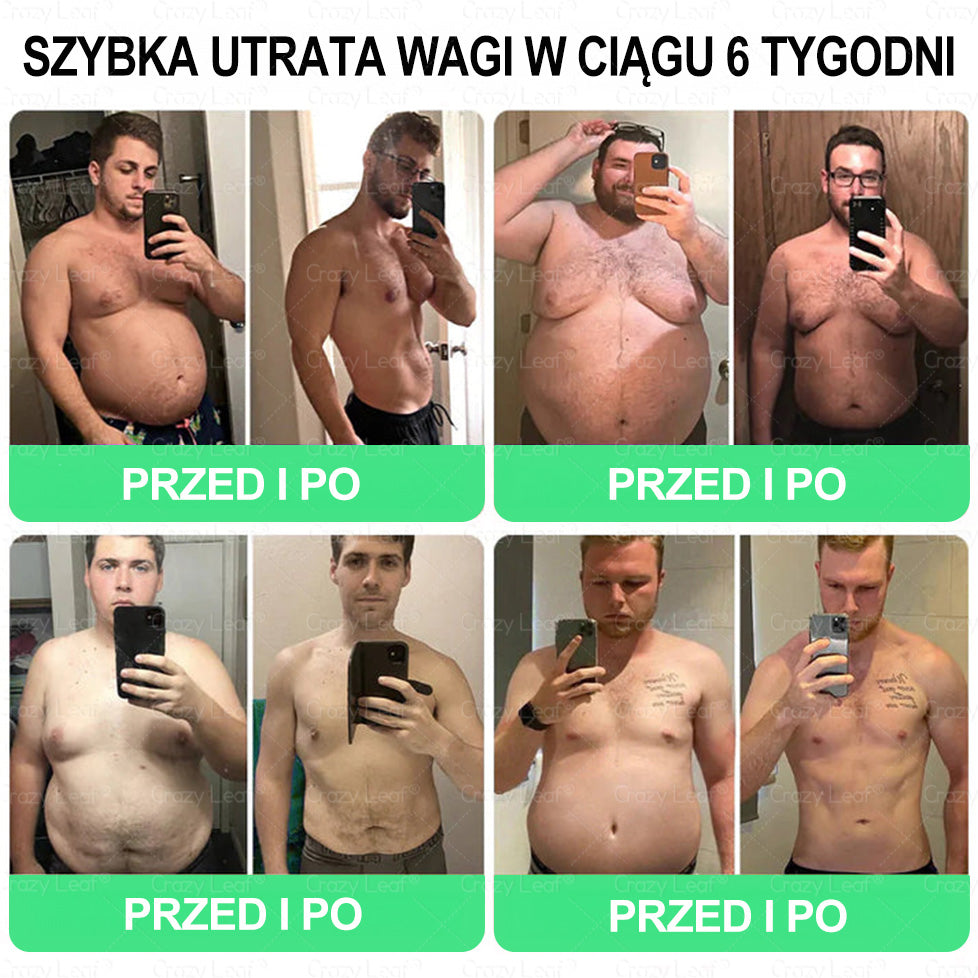 🏥 Klinicznie potwierdzone | CrazyLeaf® SMGT-GLP-1 Slim & Vitality – rozwiązanie doustne na uporczywy tłuszcz, ciśnienie, cukier, stłuszczenie wątroby, ból stawów, zmęczenie, niski poziom energii i zwiotczałą skórę. Lepsze zdrowie, więcej energii!