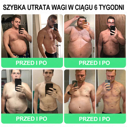 🏥 Klinicznie potwierdzone | CrazyLeaf® SMGT-GLP-1 Slim & Vitality – rozwiązanie doustne na uporczywy tłuszcz, ciśnienie, cukier, stłuszczenie wątroby, ból stawów, zmęczenie, niski poziom energii i zwiotczałą skórę. Lepsze zdrowie, więcej energii!