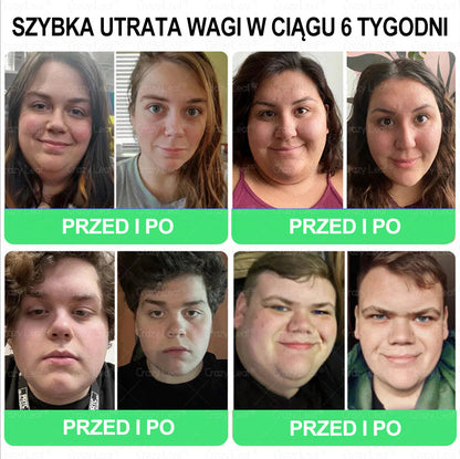 🏥 Klinicznie potwierdzone | CrazyLeaf® SMGT-GLP-1 Slim & Vitality – rozwiązanie doustne na uporczywy tłuszcz, ciśnienie, cukier, stłuszczenie wątroby, ból stawów, zmęczenie, niski poziom energii i zwiotczałą skórę. Lepsze zdrowie, więcej energii!