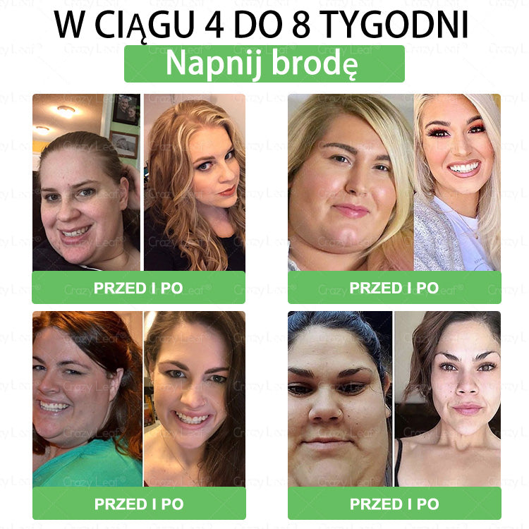 🏥 Klinicznie potwierdzone | CrazyLeaf® SMGT-GLP-1 Slim & Vitality – rozwiązanie doustne na uporczywy tłuszcz, ciśnienie, cukier, stłuszczenie wątroby, ból stawów, zmęczenie, niski poziom energii i zwiotczałą skórę. Lepsze zdrowie, więcej energii!