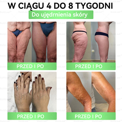 🌻BuildLeaf®Tylko 10 opakowań! Skorzystaj z wyjątkowej 30% zniżki już teraz! Nie przegap swojej szansy—taka oferta nie pojawi się ponownie aż do przyszłego roku. Działaj szybko! 180-dniowa gwarancja zwrotu pieniędzy